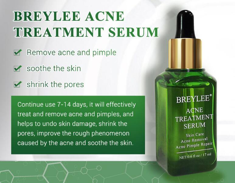 Acne Treatment Serum Facial Repair Oil Acne Treatment Serum Facial Repair Oil